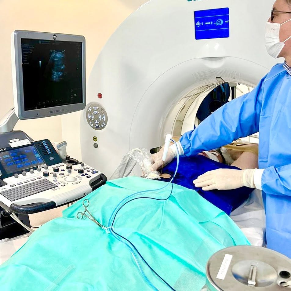 Procedimento guiado por ultrassom e tomografia
